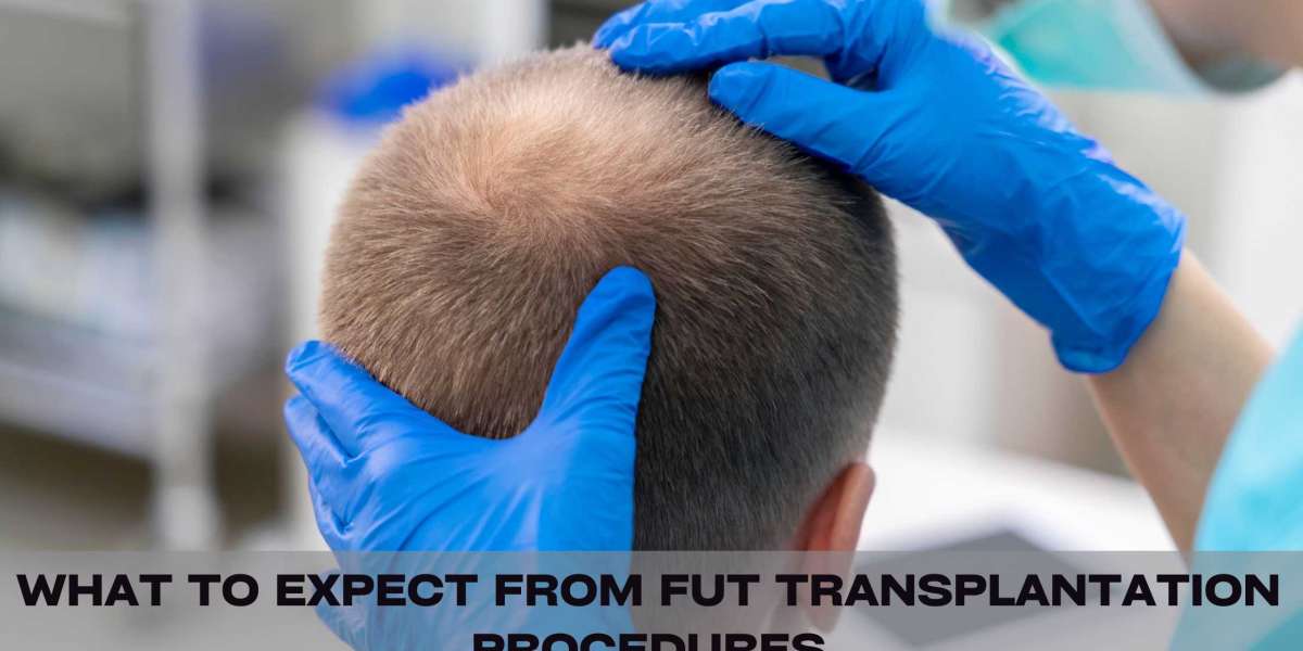 What to Expect from FUT Transplantation Procedures