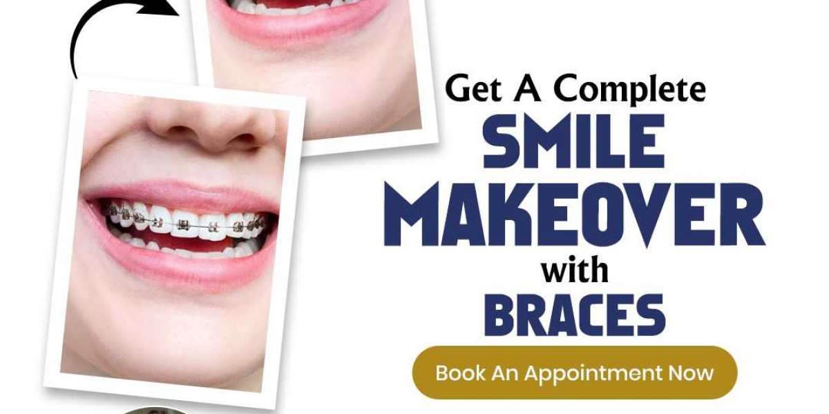Your Smile, Our Priority: Discover Marudhar Dental Clinic – The Best Dentist in Jaipur!