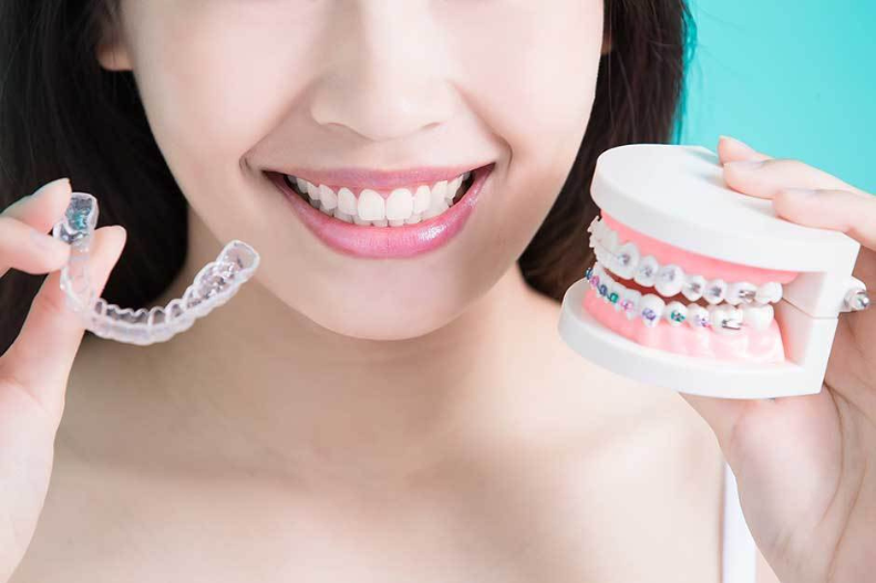 Teeth Aligners Explained: Types, Benefits, And Costs