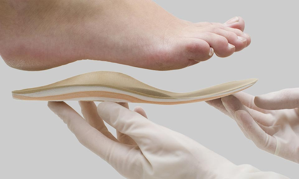 Custom Insoles for High Arches: A Must for Runners Comfort
